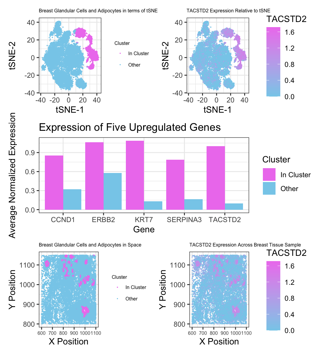 Identifying Glandular Cells and Adipocytes in Breast Tissue