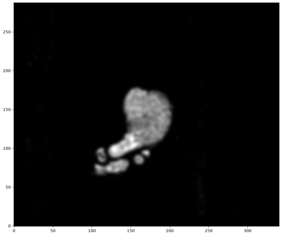 ../_images/notebooks_heart-alignment_13_0.png