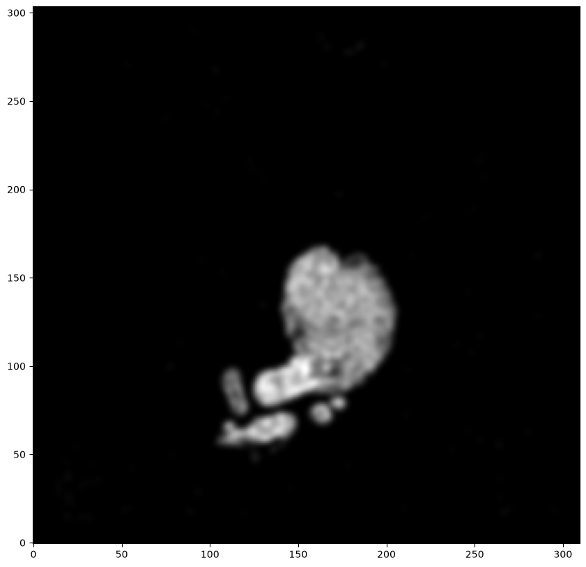 ../_images/notebooks_heart-alignment_9_0.png