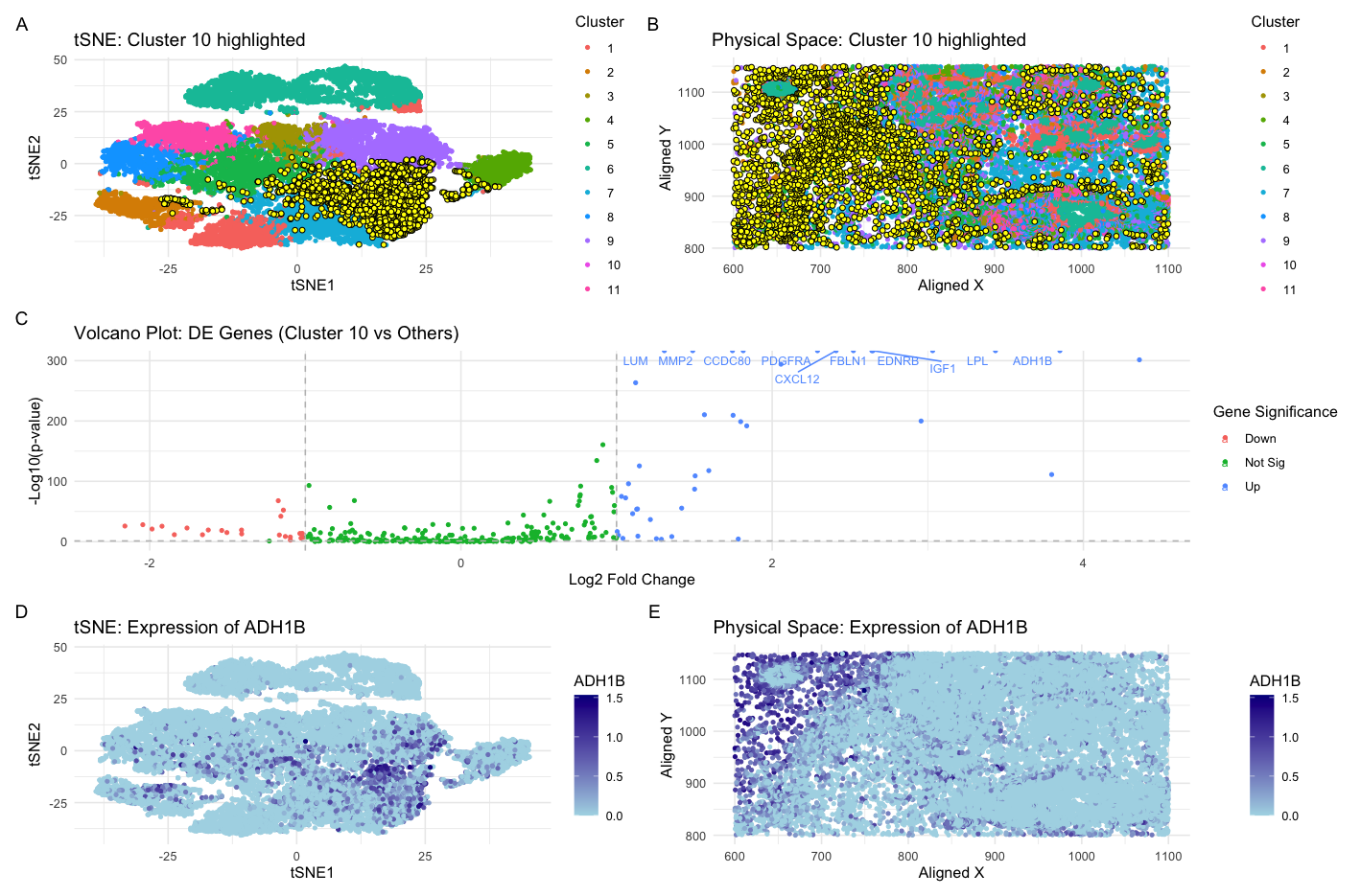 Identification of Adipocyte-like/Lipid-metabolizing Cells in Breast Cancer Tissue