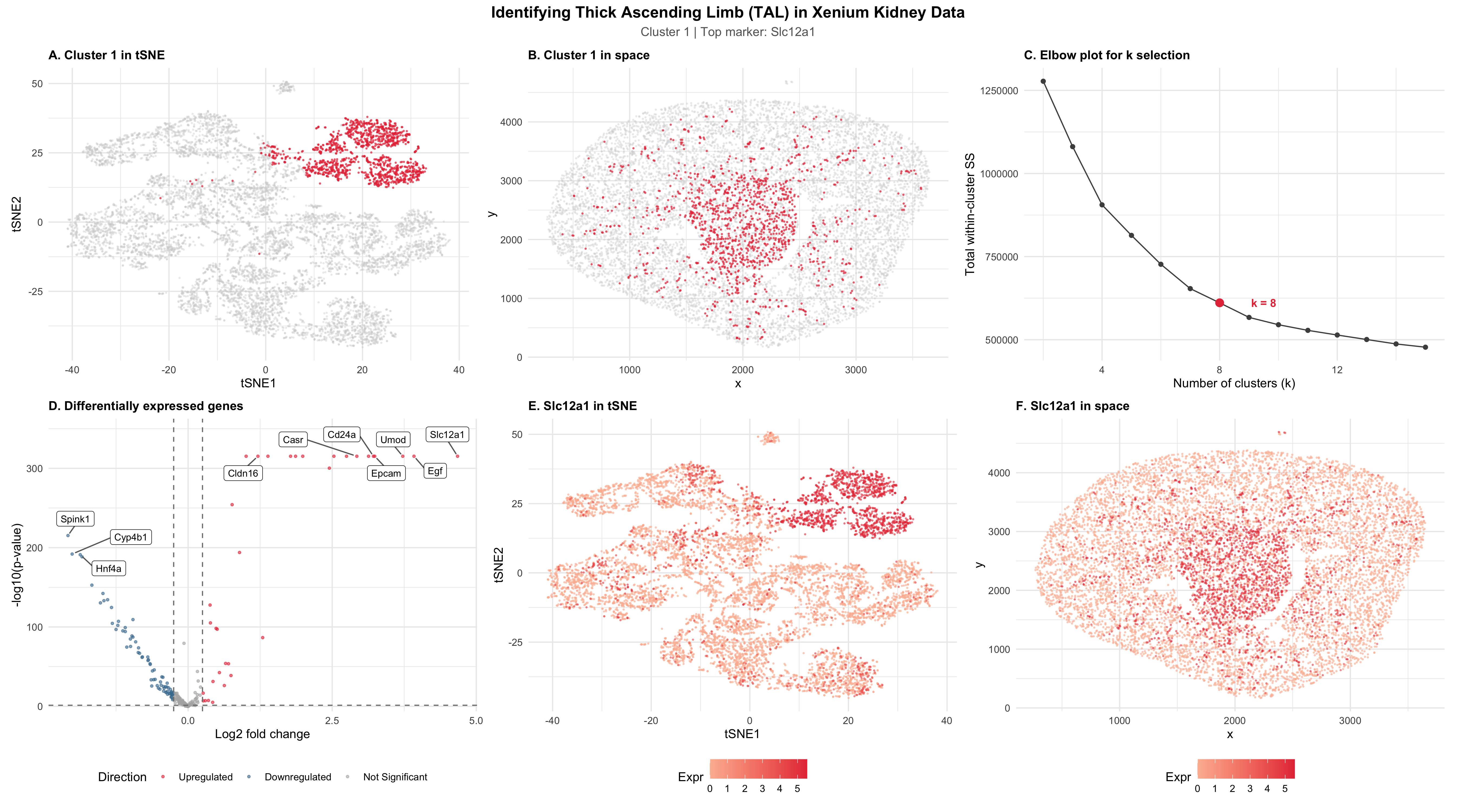 Identification of Thick Ascending Limb Cells in Xenium Dataset